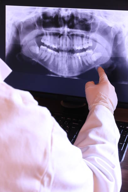 Best Emergency Dental Care for Broken or Chipped Teeth in Pittsboro, IN